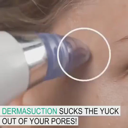 مزيل الرؤوس السوداء