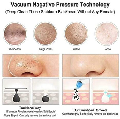 مزيل الرؤوس السوداء