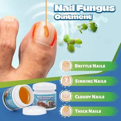 مرهم فطريات الأظافر